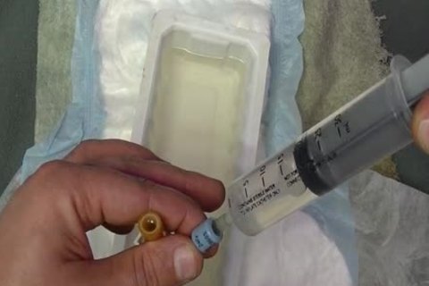 I set in A 24 French Catheter In Me. I Take In 500 ML Of Water In My Bladder. whilst My Bladder Is To The Bursting Point Play With Myself To The Point